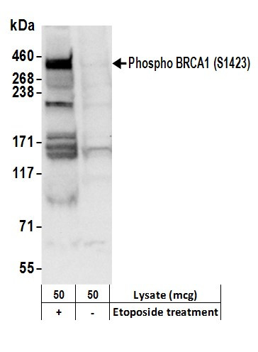 Phospho-BRCA1 (Ser1423) Antibody in Western Blot (WB)