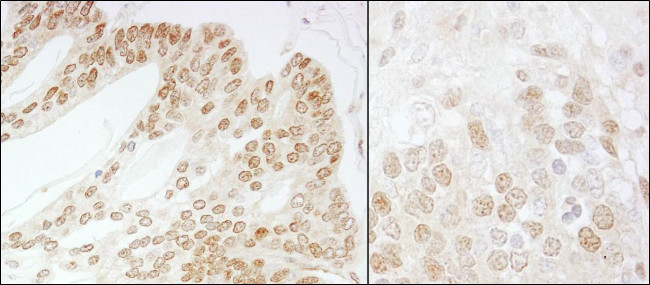 CSN5 Antibody in Immunohistochemistry (Paraffin) (IHC (P))