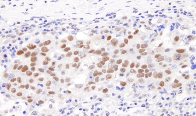 GTF2I/TFII-I Antibody in Immunohistochemistry (Paraffin) (IHC (P))