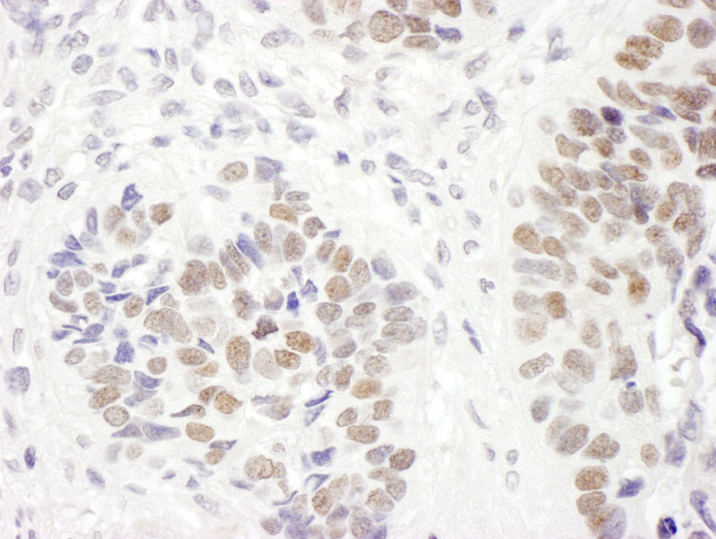 MSH6 Antibody in Immunohistochemistry (Paraffin) (IHC (P))