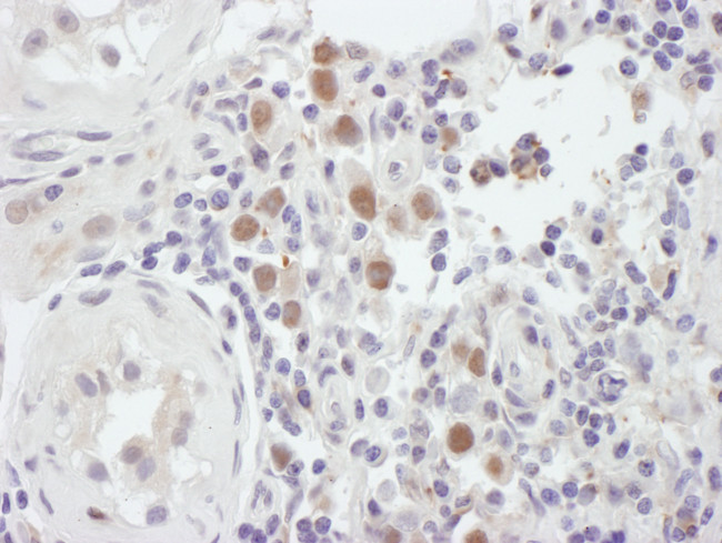 MSH6 Antibody in Immunohistochemistry (Paraffin) (IHC (P))