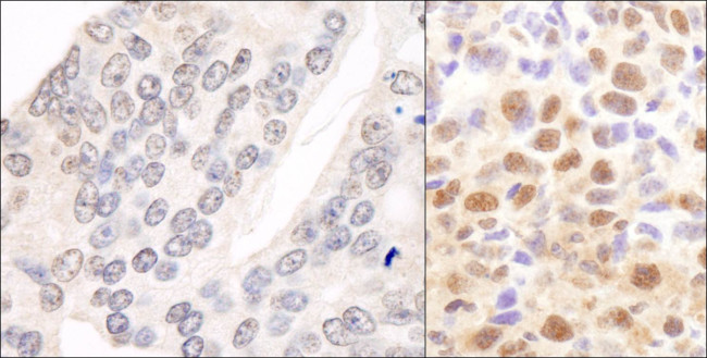 CSN2 Antibody in Immunohistochemistry (Paraffin) (IHC (P))