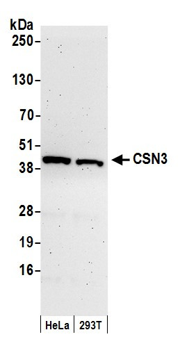 CSN3 Antibody in Western Blot (WB)
