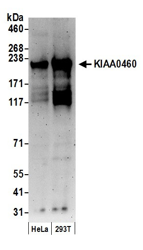 KIAA0460 Antibody in Western Blot (WB)