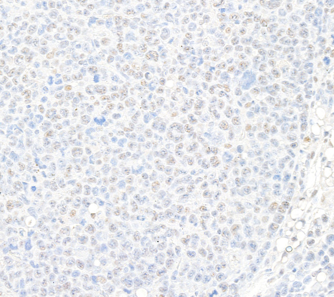 USP7 Antibody in Immunohistochemistry (Paraffin) (IHC (P))