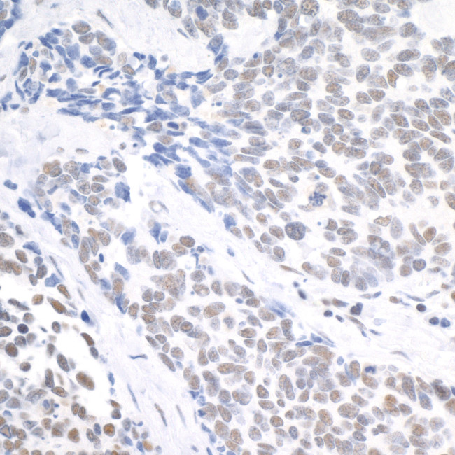 USP7 Antibody in Immunohistochemistry (Paraffin) (IHC (P))