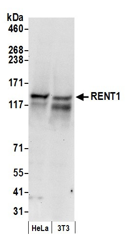 RENT1 Antibody in Western Blot (WB)