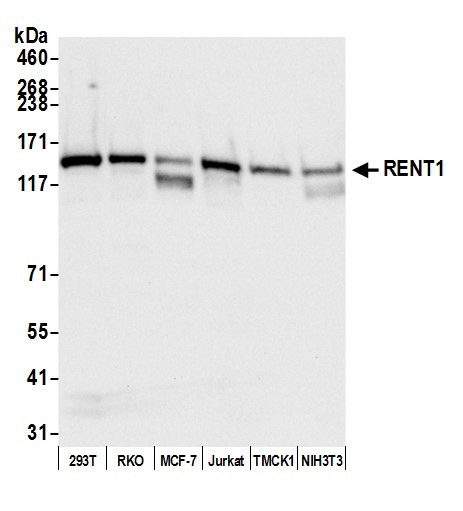 RENT1 Antibody in Western Blot (WB)