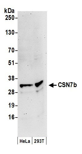 CSN7b Antibody in Western Blot (WB)