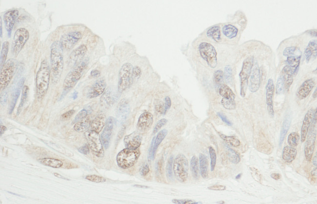 MDC1 Antibody in Immunohistochemistry (Paraffin) (IHC (P))
