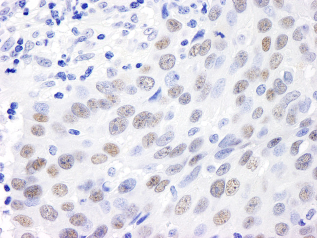 MDC1 Antibody in Immunohistochemistry (Paraffin) (IHC (P))