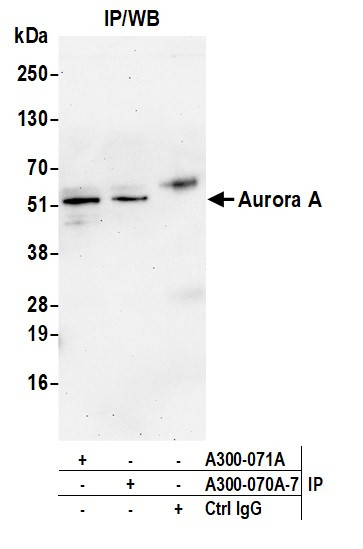 Aurora A Antibody in Immunoprecipitation (IP)
