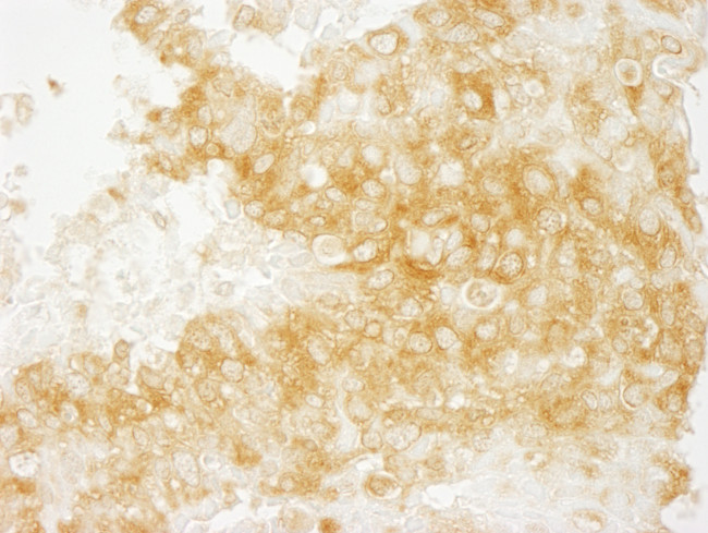 Diaphanous 1 Antibody in Immunohistochemistry (Paraffin) (IHC (P))