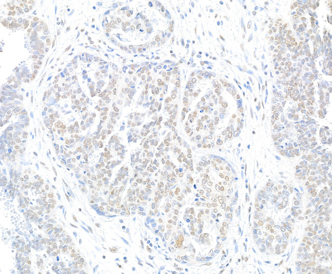 H2AX Antibody in Immunohistochemistry (Paraffin) (IHC (P))