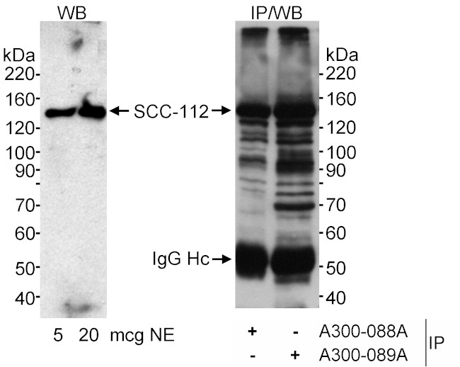 SCC-112 Antibody in Western Blot (WB)