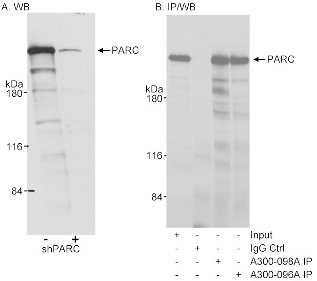 PARC/H7-AP1 Antibody in Western Blot (WB)