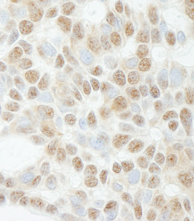ADNP Antibody in Immunohistochemistry (Paraffin) (IHC (P))