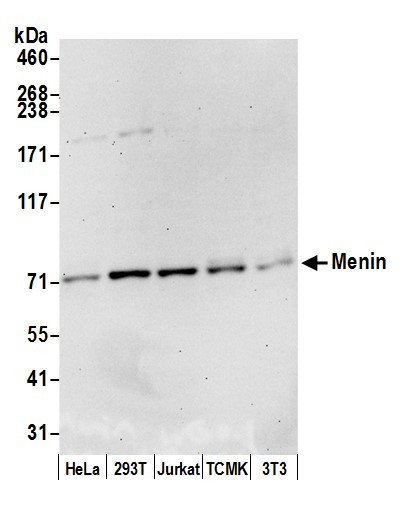 Menin Antibody in Western Blot (WB)