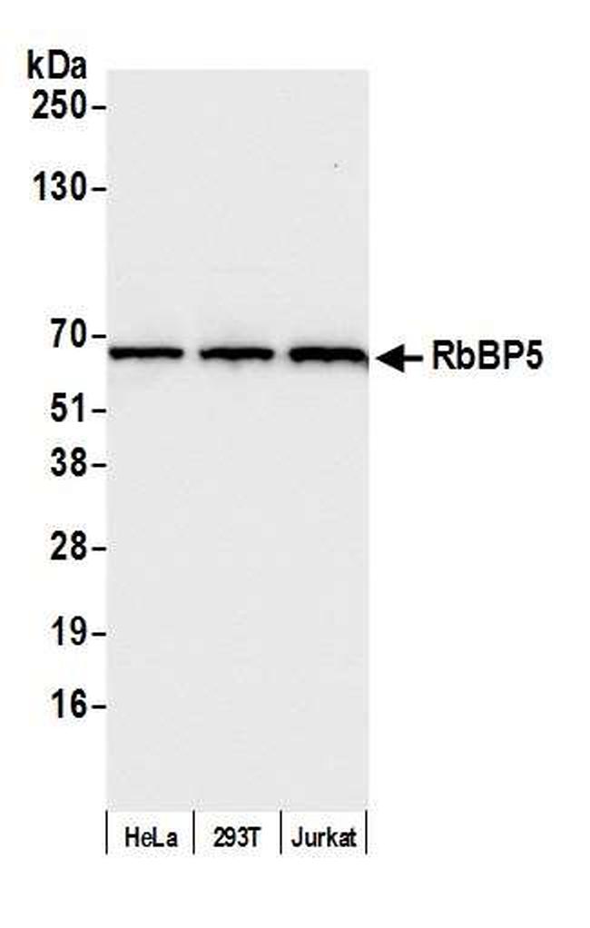 RbBP5 Antibody in Western Blot (WB)