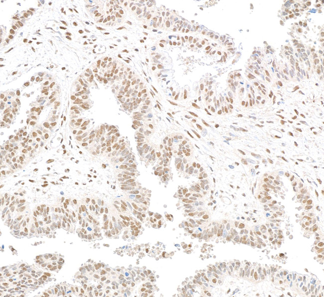 RbBP5 Antibody in Immunohistochemistry (Paraffin) (IHC (P))