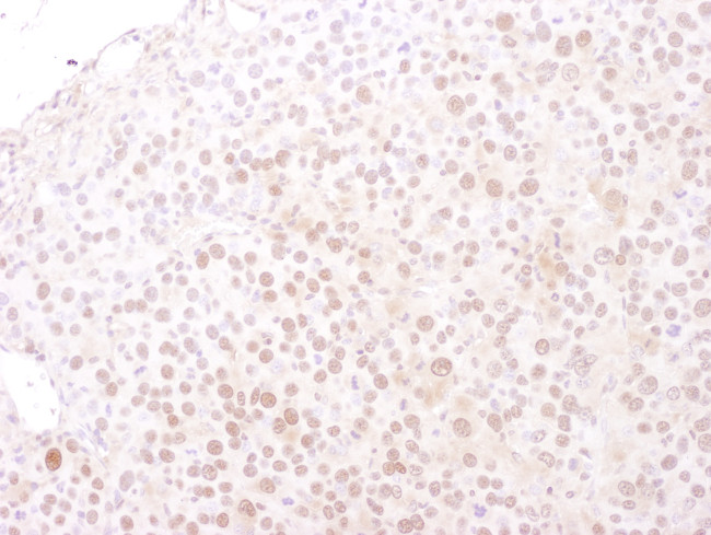 MCM4 Antibody in Immunohistochemistry (Paraffin) (IHC (P))