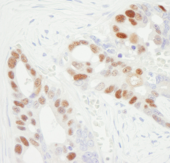 MCM6 Antibody in Immunohistochemistry (Paraffin) (IHC (P))