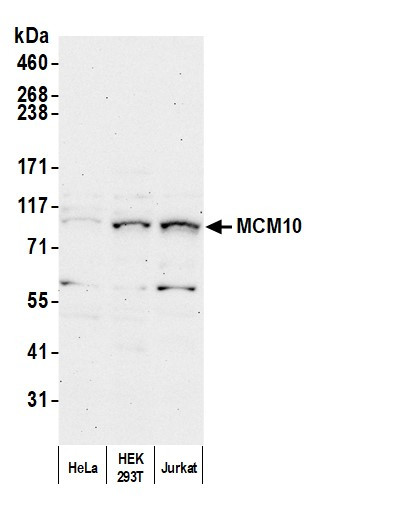 MCM10 Antibody in Western Blot (WB)