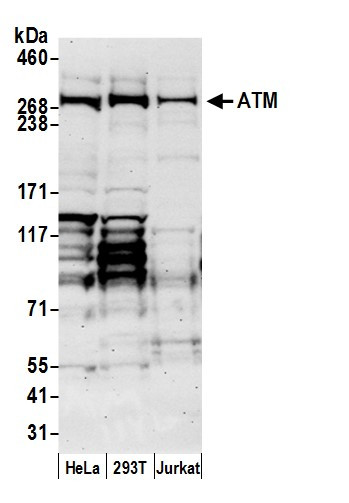 ATM Antibody in Western Blot (WB)