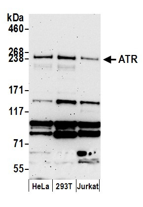 ATR Antibody in Western Blot (WB)