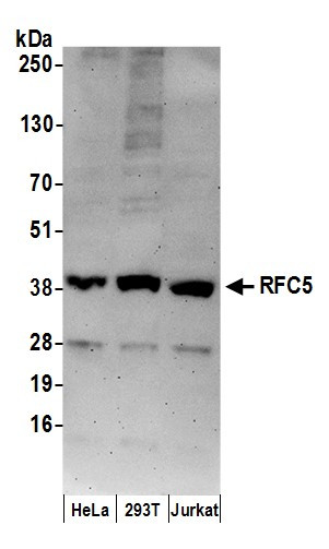 RFC5 Antibody in Western Blot (WB)