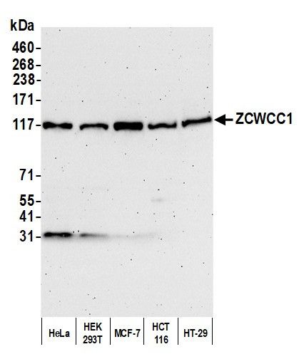 ZCWCC1 Antibody in Western Blot (WB)