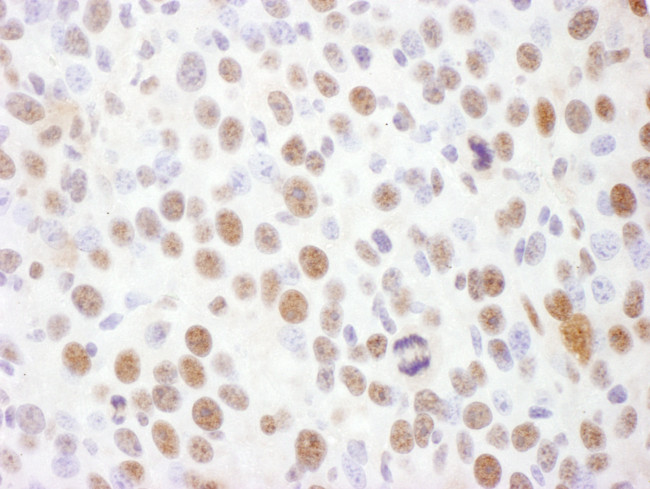 Phospho-Rad17 (Ser645) Antibody in Immunohistochemistry (Paraffin) (IHC (P))