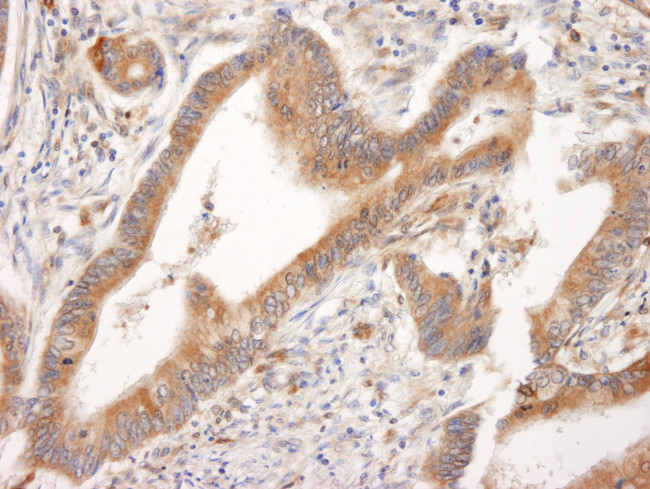 BID Antibody in Immunohistochemistry (Paraffin) (IHC (P))