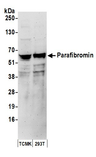 Parafibromin Antibody in Western Blot (WB)