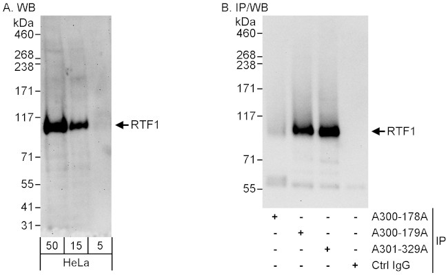 Rtf1 Antibody in Western Blot (WB)