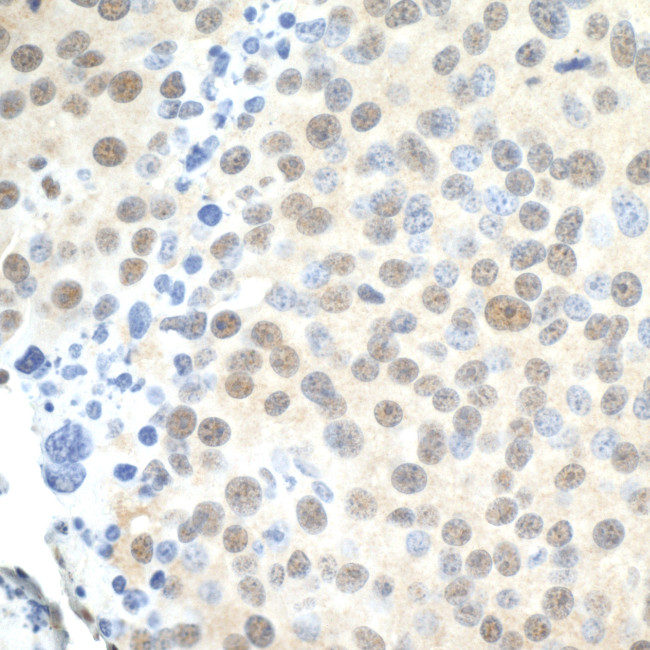 PELP1/MNAR Antibody in Immunohistochemistry (Paraffin) (IHC (P))
