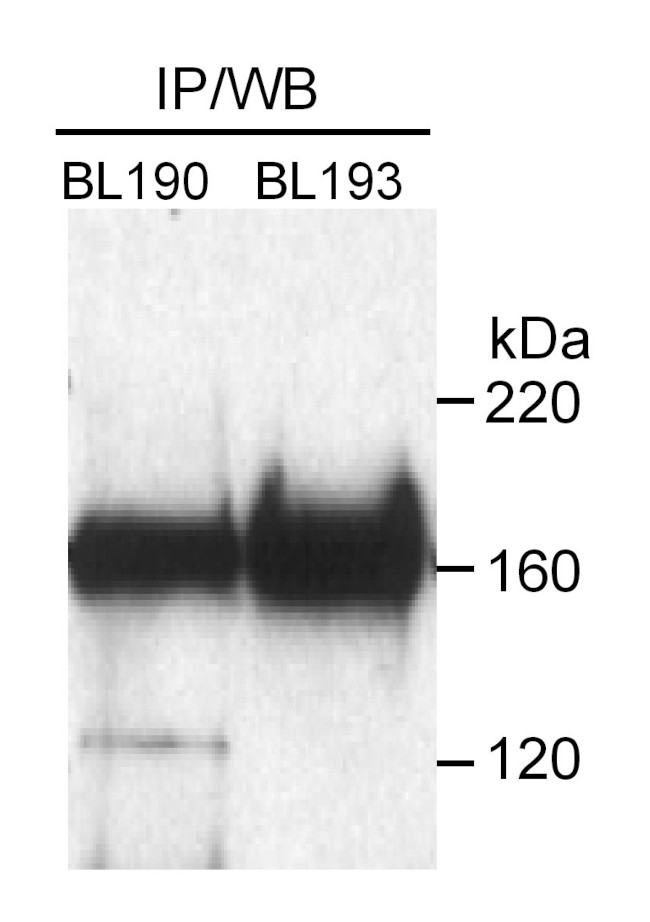 Rad50 Antibody in Immunoprecipitation (IP)