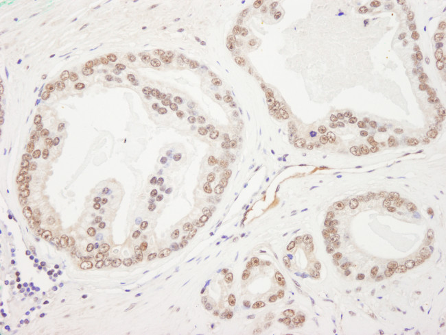Rad50 Antibody in Immunohistochemistry (Paraffin) (IHC (P))