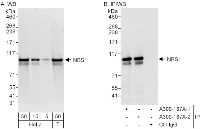 NBS1 Antibody in Western Blot (WB)