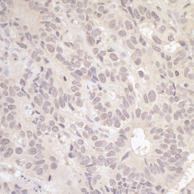 RFC3 Antibody in Immunohistochemistry (Paraffin) (IHC (P))