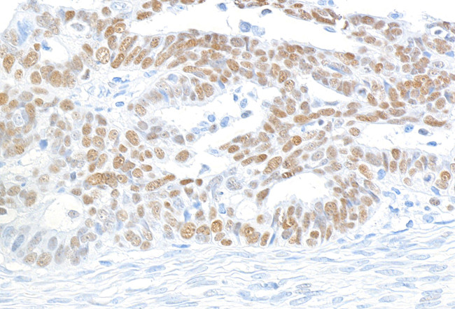 MCM2 Antibody in Immunohistochemistry (Paraffin) (IHC (P))