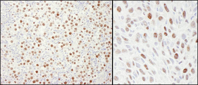 MCM4 Antibody in Immunohistochemistry (Paraffin) (IHC (P))