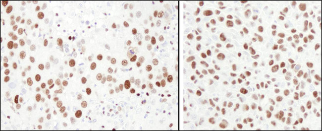 MCM6 Antibody in Immunohistochemistry (Paraffin) (IHC (P))