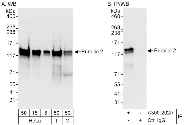 Pumilio 2 Antibody in Western Blot (WB)