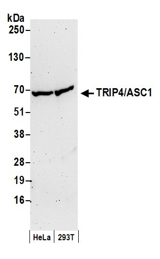 TRIP4/ASC-1 Antibody in Western Blot (WB)