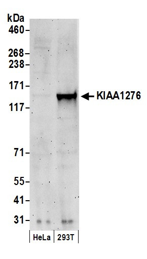 KIAA1276 Antibody in Western Blot (WB)