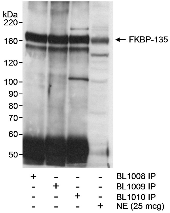 FKBP-135 Antibody in Western Blot (WB)