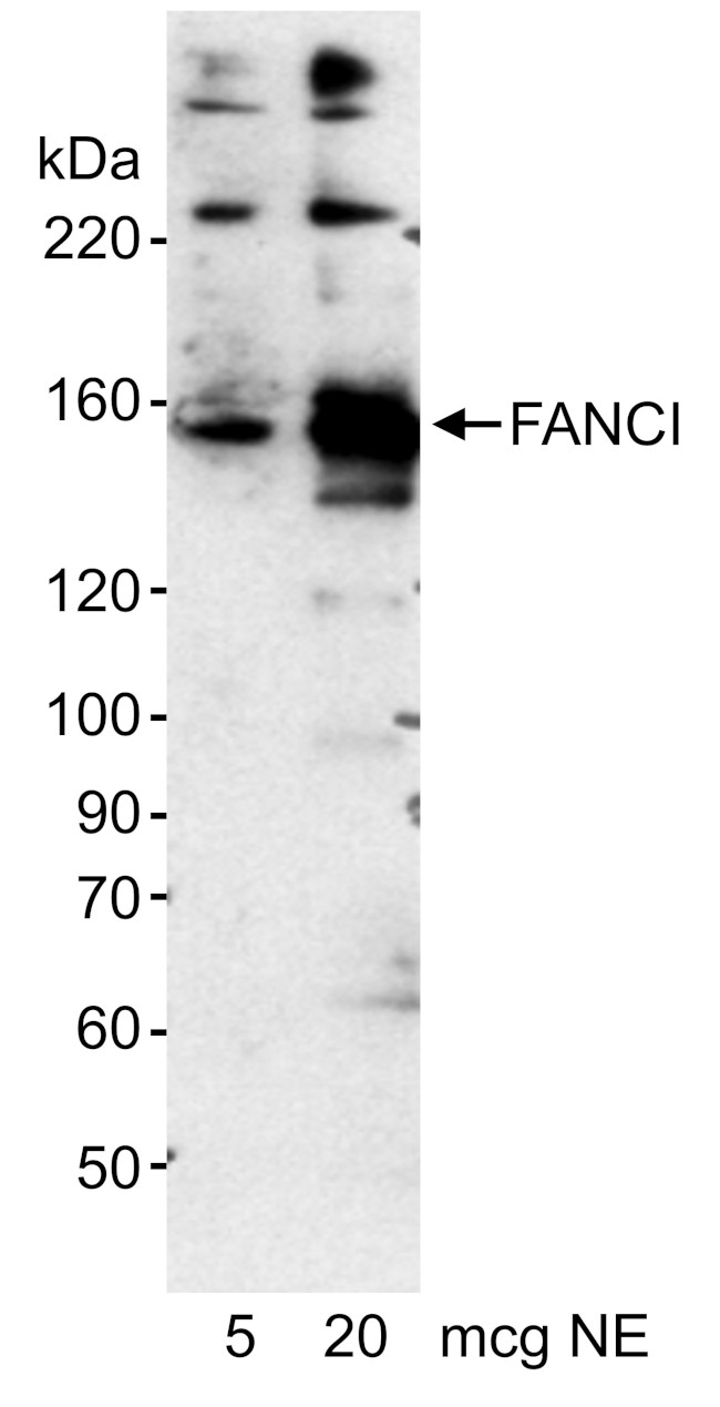 FANCI Antibody in Western Blot (WB)