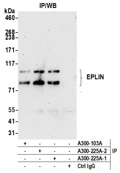EPLIN Antibody in Immunoprecipitation (IP)