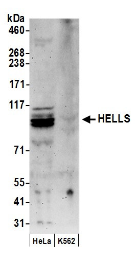 HELLS Antibody in Western Blot (WB)